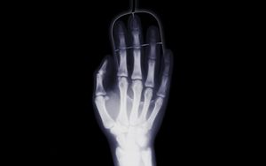 Preview wallpaper arm, x-ray, bone, computer mouse