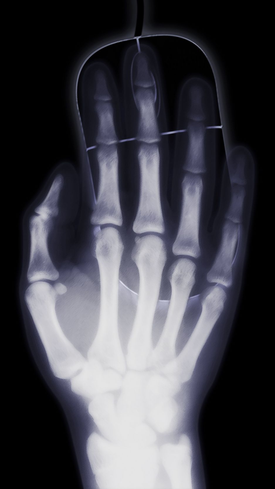 Download wallpaper 938x1668 arm, x-ray, bone, computer mouse iphone 8/7/6s/6  for parallax hd background