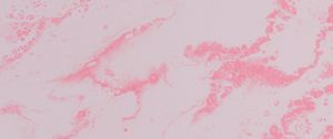 Preview wallpaper paint, liquid, spots, stains, fluid art, pink