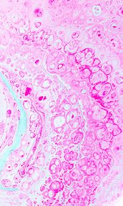 Preview wallpaper paint, stains, bubbles, liquid, pink