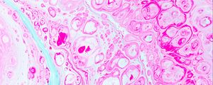 Preview wallpaper paint, stains, bubbles, liquid, pink