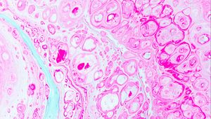 Preview wallpaper paint, stains, bubbles, liquid, pink