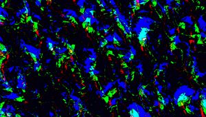 Preview wallpaper shape, glow, blue, patterns, texture